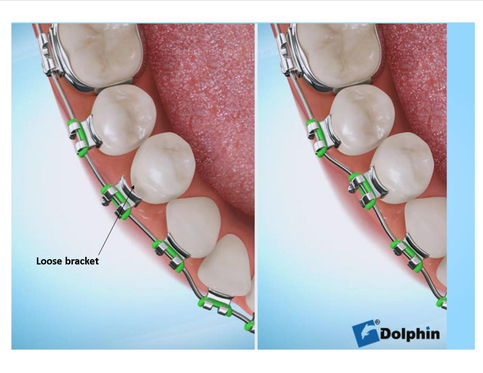 Emergency Care Forever Smiles Buffalo Grove IL